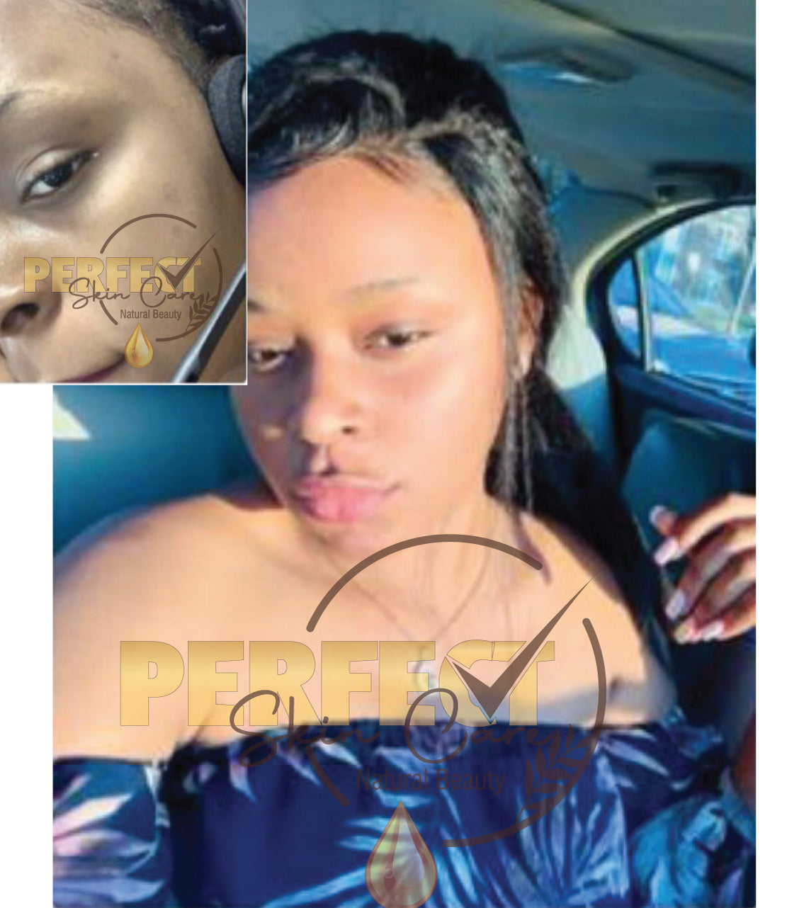 Gamme Complete "Supreme Metisse Plus" - Extreme Lightening / Whitening Full Set