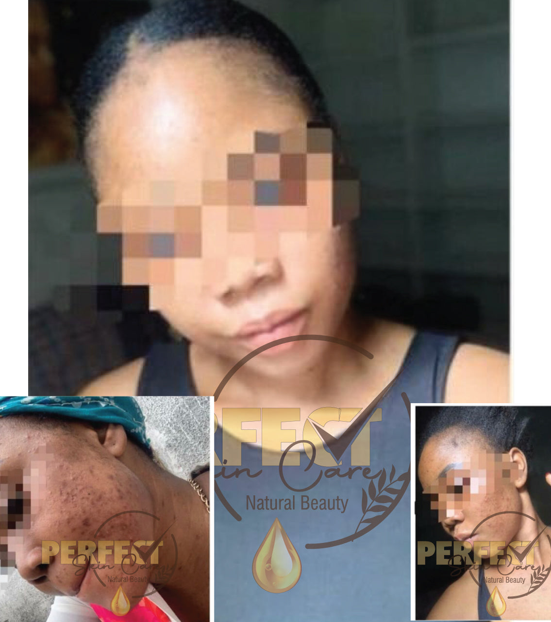 Gamme Complete "Supreme Metisse Plus" + Kit visage reparateur - Extreme Lightening / Whitening Full Set + Repair face set