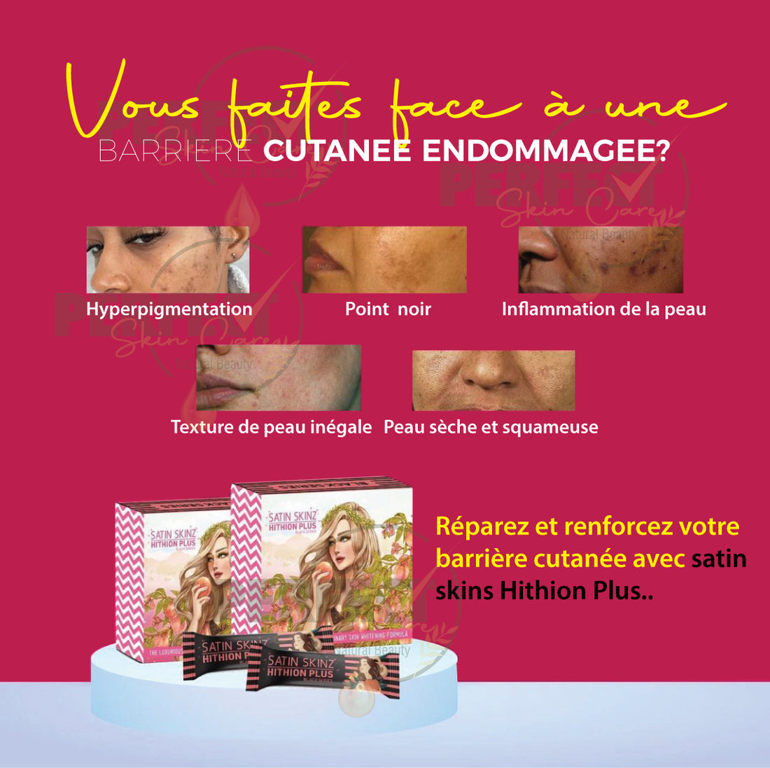 Satin Skinz HITHION PLUS - Meilleur Complement alimentaire pour Peaux Noires, Claires et Métissées