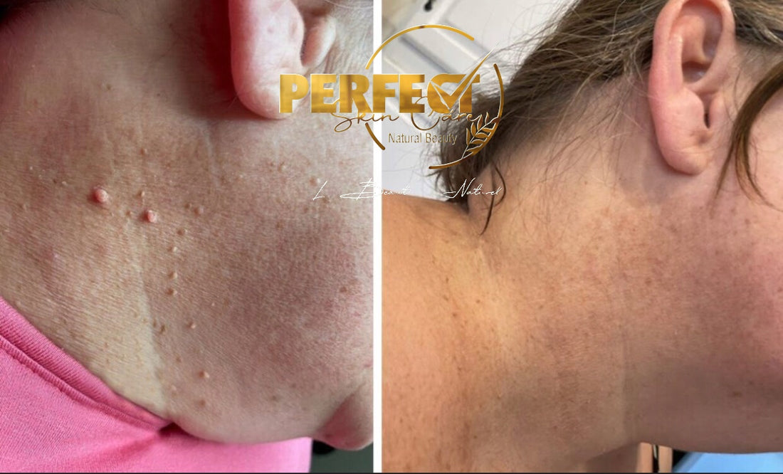 NOUVEAU‼️🍁 HUILE DE LUXE POUR L&