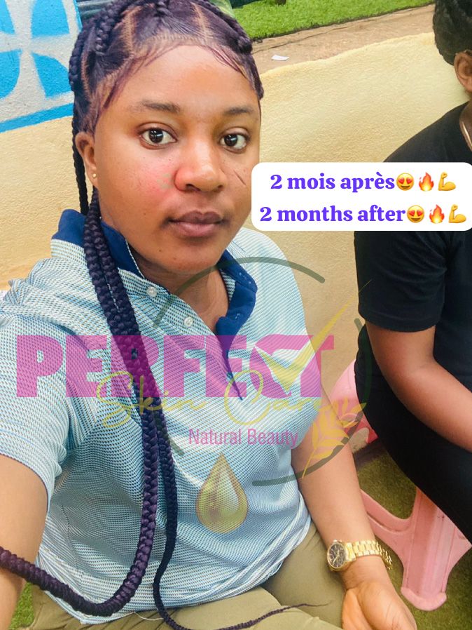 Retour: Gamme réparatrice et éclaircissante (vissage avec taches et boutons) + Kit Quintos