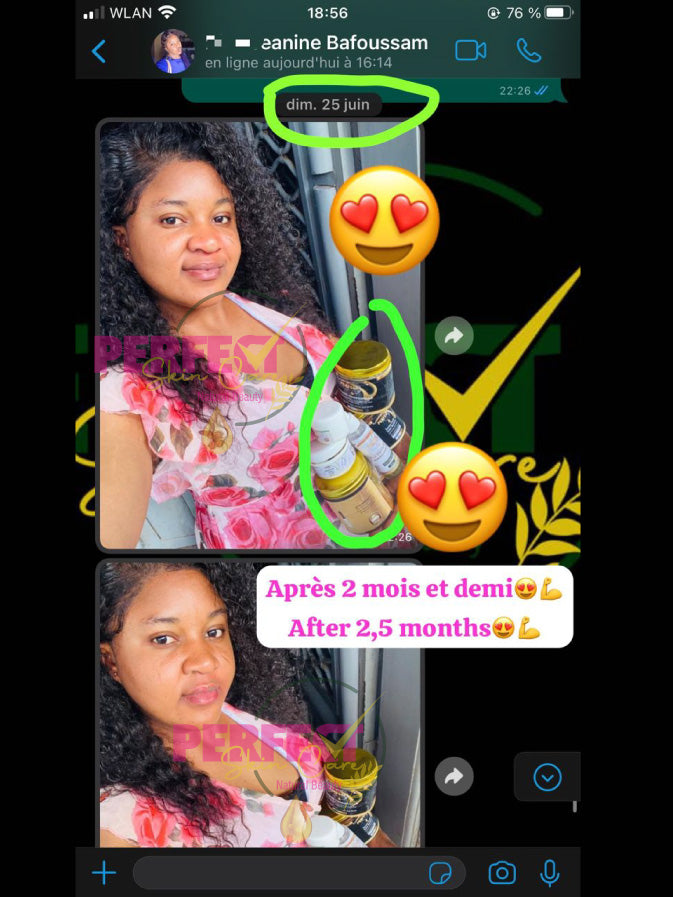 Retour: Gamme réparatrice et éclaircissante (vissage avec taches et boutons) + Kit Quintos