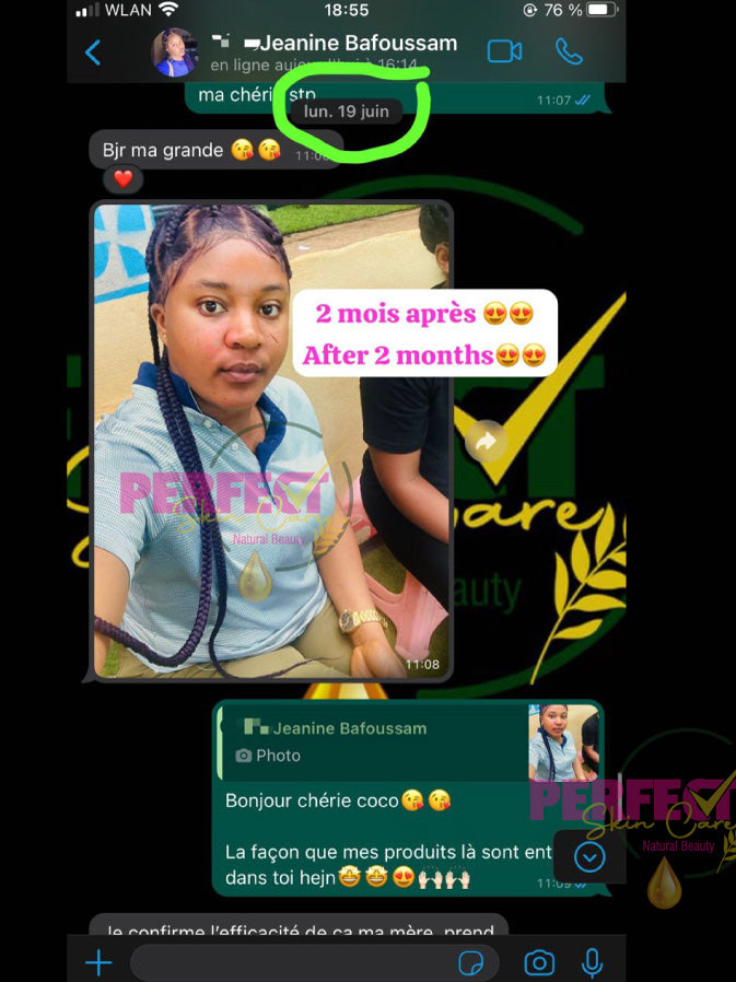 Retour: Gamme réparatrice et éclaircissante (vissage avec taches et boutons) + Kit Quintos