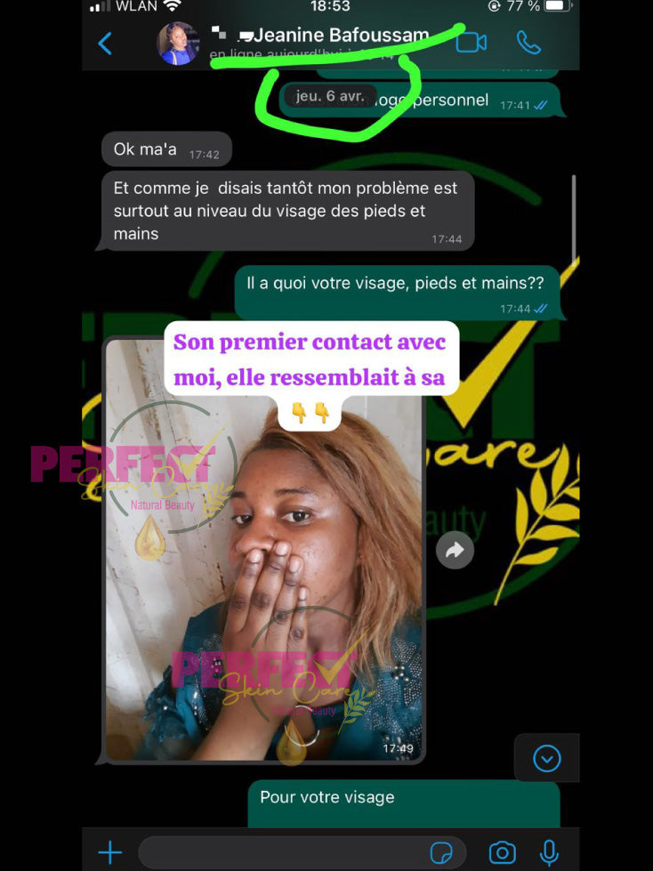 Retour: Gamme réparatrice et éclaircissante (vissage avec taches et boutons) + Kit Quintos