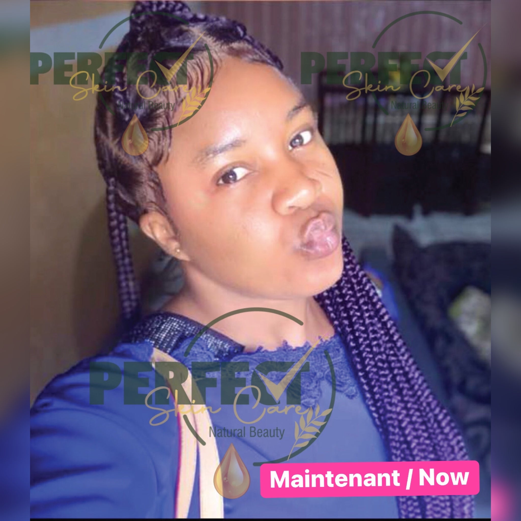 Retour: Gamme réparatrice et éclaircissante (vissage avec taches et boutons) + Kit Quintos